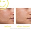 MEGA-C™ 30% Vitamin C Brightening Facial