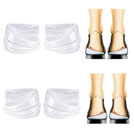 Two Pairs Overpronation Insoles,3 Layers Adjustable Heel Wedge Corrective Inserts,Correct Excessive Pronation and Upward Rotation,Women Men Xo Leg Shapeorthotic Insoles (S)