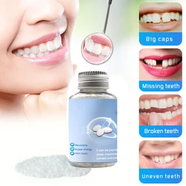 Healthyare Tooth Repair Kit, Moldable False Teeth Thermal Fitting Beads,Temporary Filling Broken Teeth Gap for Snap On Instant and Confident Smile, Denture Adhesive