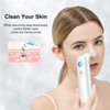 KD802 Blackhead Remover Pore Vacuum Pimple Extractor Acne Removal Kit