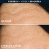 Roc Multi Correxion Revive Limpiador Facial Gel Brillante Vitamina Ácido