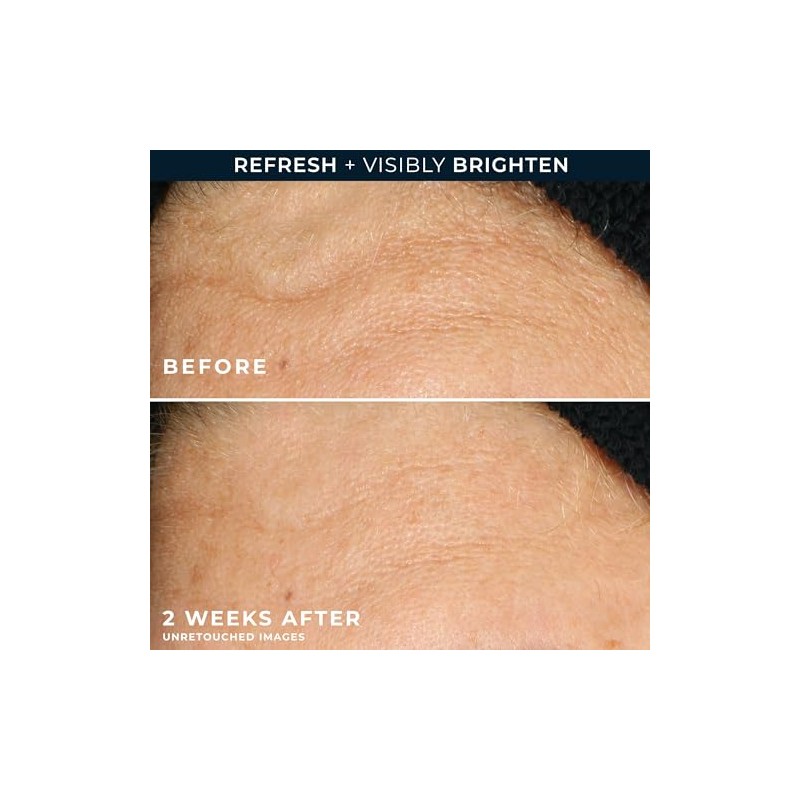 Roc Multi Correxion Revive Limpiador Facial Gel Brillante Vitamina Ácido