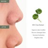 Dr.Althea [Dr.Althea]2% Salicylic Acid Clear Pad
