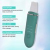 EMS Ultrasonic Skin Scrubber Blackhead Pimple Removal Lifting Ion Pore