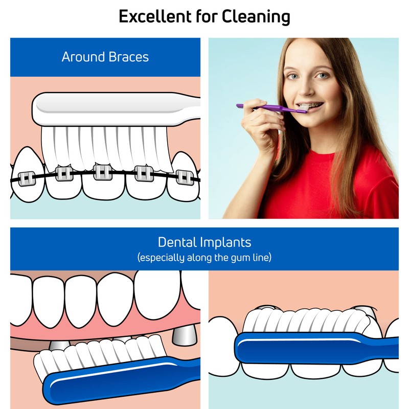 TePe Implant Orthodontic Soft Toothbrush – Extra Narrow Brush Head