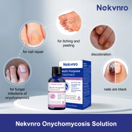 30ml Líquido Antibacteriano De Uñas Grises P/ Uñas Enfermas