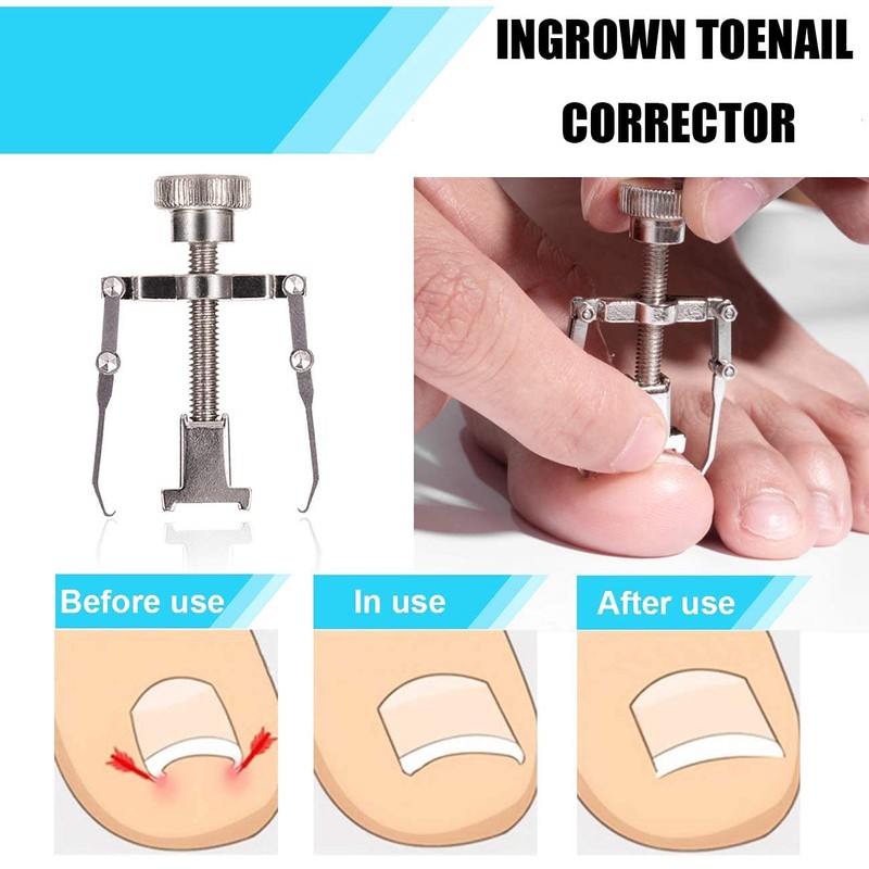 Ingrown Toenail Tool Kit (9PCS), Professional Toe Nail Clipper Set