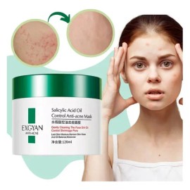Crema Facial Antiacné Exfoliante Hidratante Universo en Línea 120ml                                                                                   