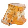 1pc Orange Color Dental Disease Removable Study Teaching Teeth Model