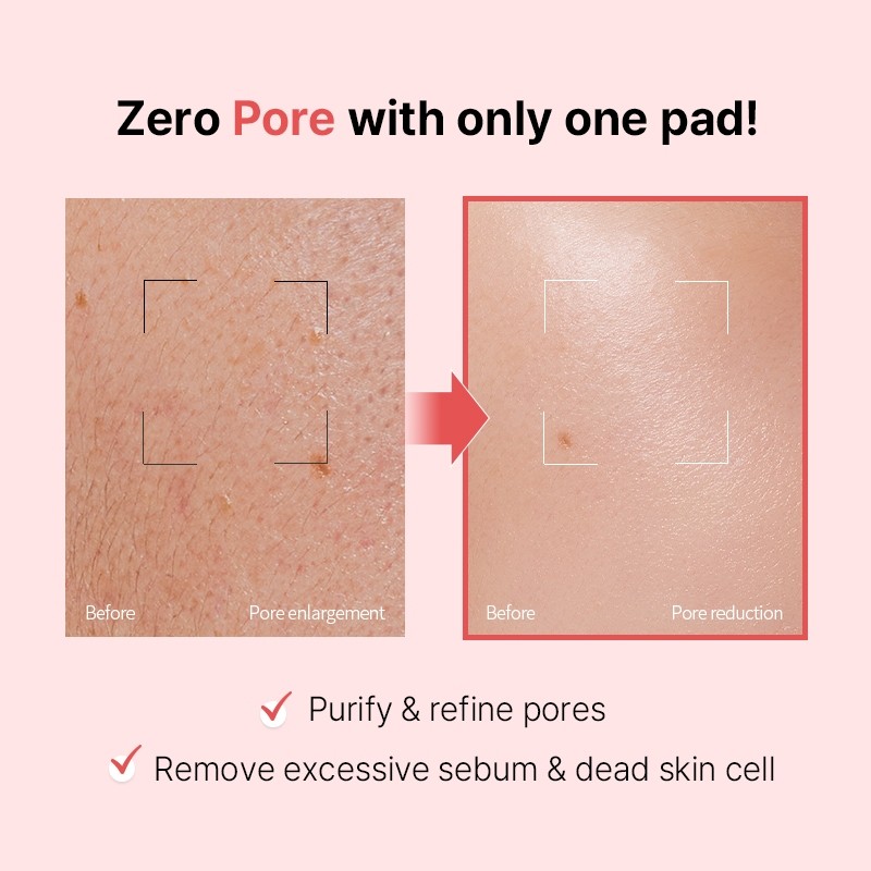 Veganifect [Veganifect]Lifting And Balancing Fig Chestnut Pore Fit Toner Pad