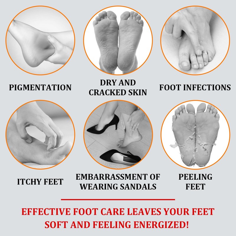 XMXueMei Foot Peeling Spray Oil,Moisturizing Nourishing Foot Exfoliating Peeling Spray,Instantly