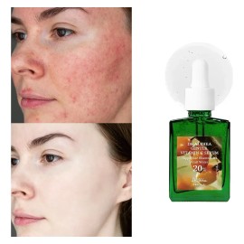Suero Facial Dr Althea Vitamina C 20% 30 Ml Todo Tipo De Piel Día/noche
