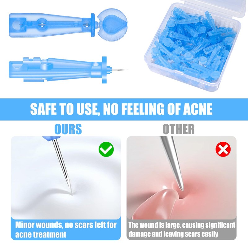 100Pcs Disposable Acne Needles Sterile Pimple Popper Kit with Precision