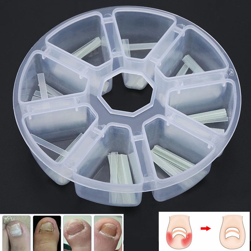 120pcs/box Ingrown Pedicure Toenail Straightening Clip Toe Nail Sticker Patch