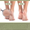 Foot File Double Sided Callus File Foot Care Callus Rasp