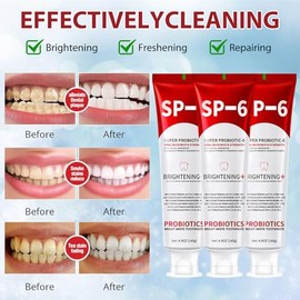 Sp-6 Pasta de dientes blanqueadora probiótica, Sp-6 Pasta dental superblanqueadora, Pasta de dientes para el cuidado de la limpieza profunda, aliento 