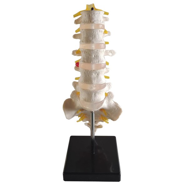 XMASIR Human Lumbar Model with A Herniated Disc at L5