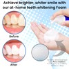 Swissklip Teeth Whitening Foam | Mint Flavor Whitening Toothpaste |