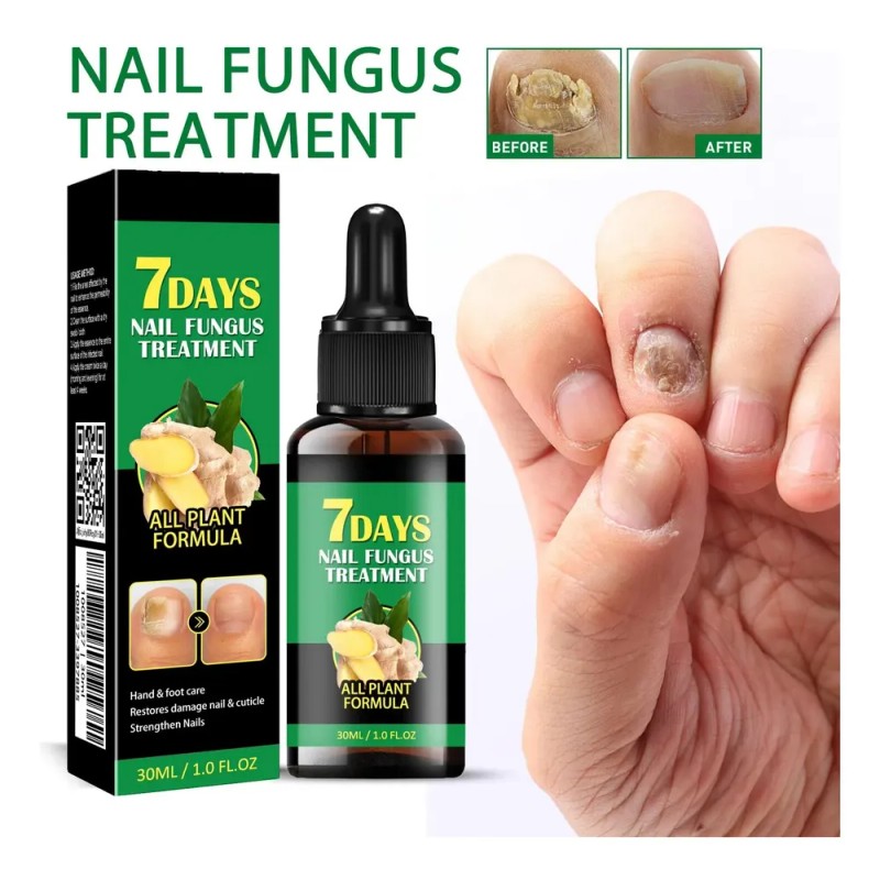 Lápiz Líquido Reparador De Uñas, Tratamiento Para Hongos En