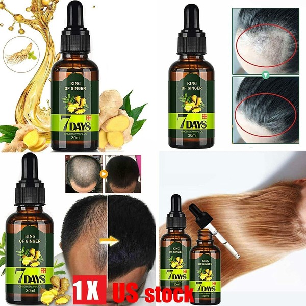 Regrow 7 Day Ginger Germinal Hair Growth Serum Hairdressing Loss Treatment Oil