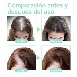 Aceite De Romero：Aceite de Romero para El Cabello-100%, Aceite Esencial de Romero para Cabello ，Estimula el Crecimiento del Cabello, Ideal para Cejas,