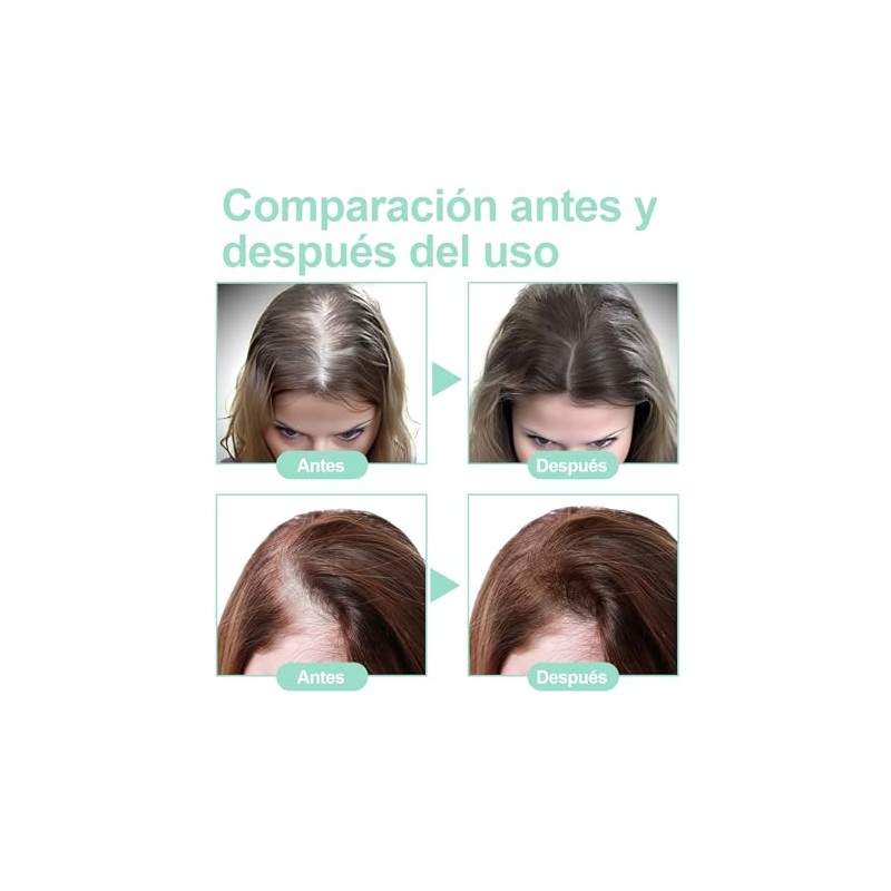 Aceite De Romero：Aceite de Romero para El Cabello-100%, Aceite Esencial