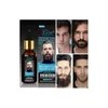 Aceite Para Barba Y Bigote 30ml Nutrición Crecimiento Brillo