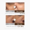 Medicube Deep Vitamin C Capsule Serum | Hydrating Vitamin C