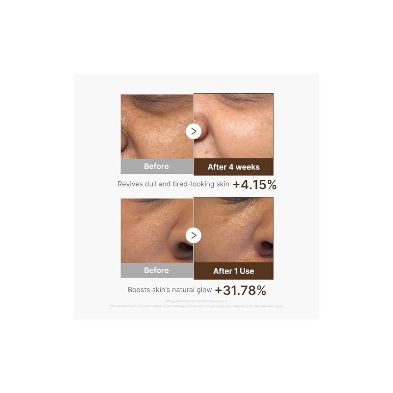 Medicube Deep Vitamin C Capsule Serum | Hydrating Vitamin C