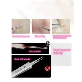 Professional Facial Blackhead Remover Tweezers,Extra<wbr/>ctor Acne Removal Kit