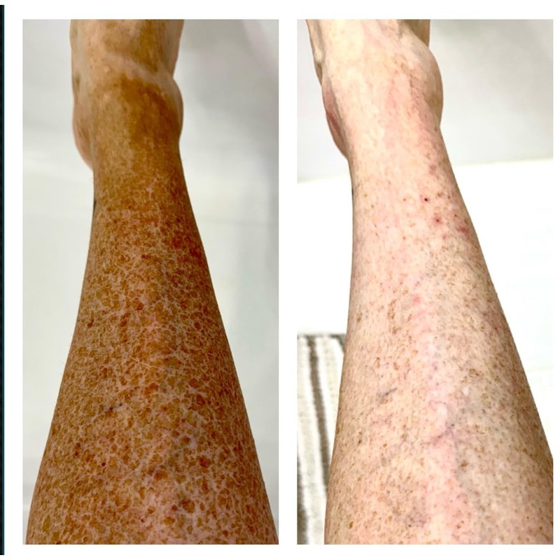 Tan Alchemy Clean Slate Sunless Tan Remover, 4 oz, 60-Second