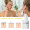 Lanbena Blackhead Remover Nose Plant Pore Strip Deep Cleansing Peel