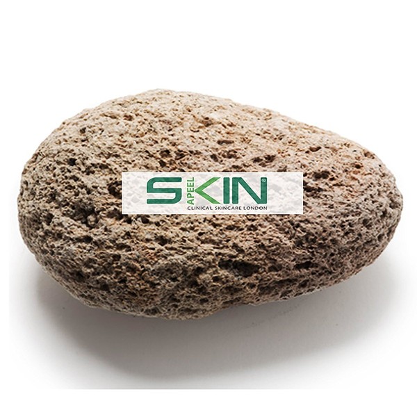 Skinapeel Large Pumice Stone - Natural Foot Care Scruber - Dead Hard Skin Callus Remover - Pedicure Tool - Skinapeel UK Skincare Specialists by Skinapeel