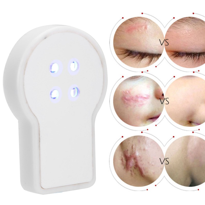 USB Plug In Mini Handheld Acne Removal Machine Blue Light