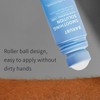 Smoothing Solution Ingrown Hair Treatment – Daily Gentle Body Care