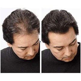 YGH Hair Building Fibers - Conceals Hair Loss in 15 Seconds - 100% Undetectable - 0.98 oz / 28g Bottle - Instantly Thicken Thinning Hair (Auburn)