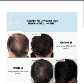 beBloomie Men's Hair Growth Vitamin Supplements Capsules, Clinically Tested for Visibly Thicker Hair and Scalp Coverage, Dermatologist Recommended - 1 Month Supply