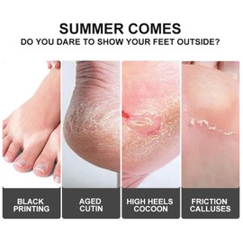 3 Pairs Foot Peel Mask - Exfoliating Foot Peel Mask -Lavender Foot Mask Peel - Callus Remover For Feet - Peeling Foot Mask Socks Moisturising Socks Foot Care - Feet Masks For Hard Skin Remover Foot