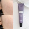 Acleon Anasis Mildly Alkaline Cleansing Foam Acne Treatment 2 Types