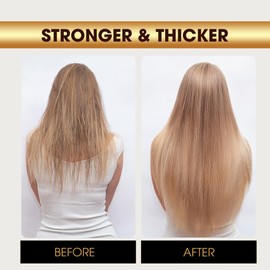 Herb Hair Growth Oil Spray for Women Men - Dry Scalp Hair Growth Serum for Combat Hair Loss, Strengthening, Boost Scalp Health to Stimulate Thinning Hair Regrowth Thicker & Longer