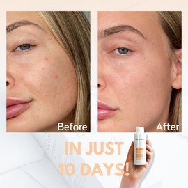 Kanzen Pore Purifier