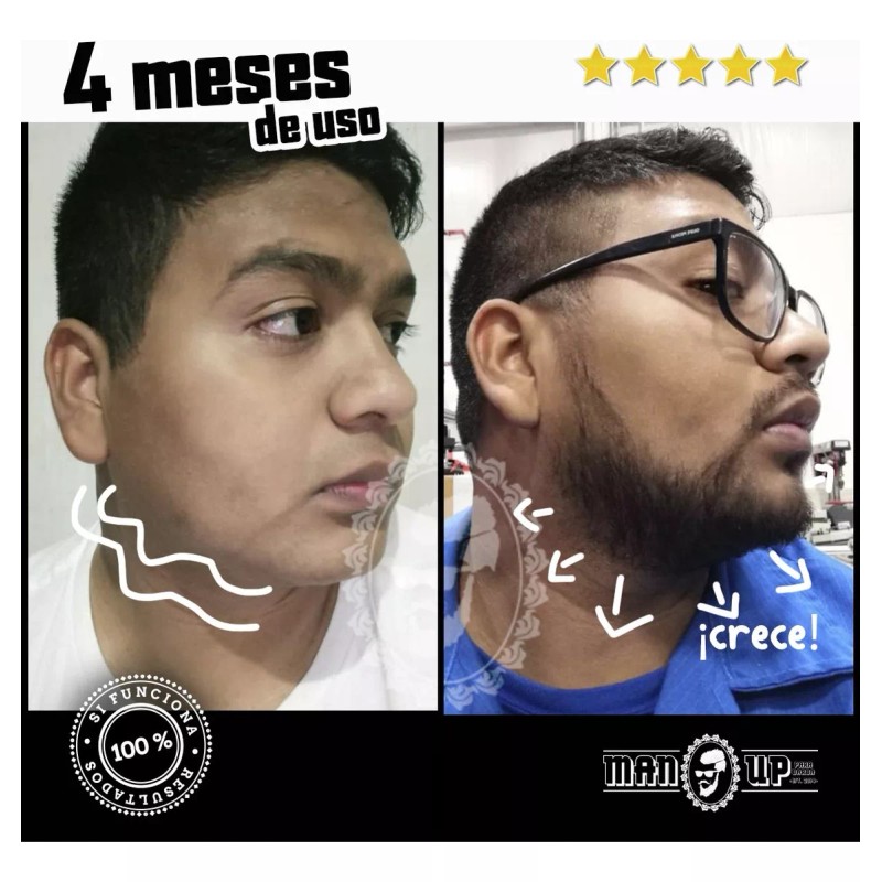 MANUP Roll On MANUP Crecimiento de Barba crecimiento de barba