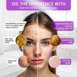 PROOX Shower Head Filter Replacement Cartridges, KDF55 Filters for Hard Water Remove Chlorine and Harmful Substances, Pack of 4