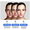 Crema Aclaradora Facial Moteada 50 G, Melasma Speckle Moistu