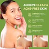 Tea Tree Soap For Face & Body Athlete's Foot Tinea