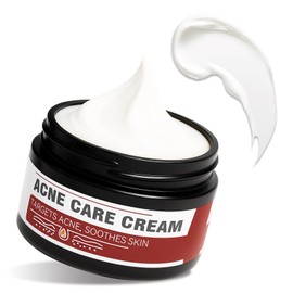 Akne Behandlung Creme, Pickel Behandlung für Fettige und Mischhaut, Sichtbare Ergebnisse in 21 Tagen, Mitesser Prävention, Sanfte Parfümfreie Formel 35g