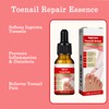 Ingrown Toenail & Cuticle Support Oil – Helps Maintain Nail