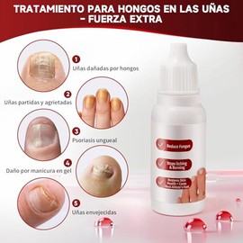 Tratamiento para Uñas de los Pies DERMFREE Fungi Nail, Fórmula Suave, Mejora Eficazmente las Uñas para una Apariencia Más Bella (1 Pieza)