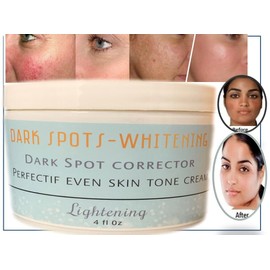 dark spots whitening Remove freckle speckle peels dark spot face facial skin whitening cream paño