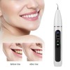Intelligent Ultrasonic Electric Dental Scaler Dental Calculus Plaque Tartar Remover